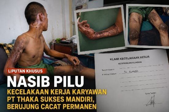 Nasib Pilu Karyawan PT Thaka Sukses Mandiri: Kecelakaan Kerja Berujung Cacat Permanen